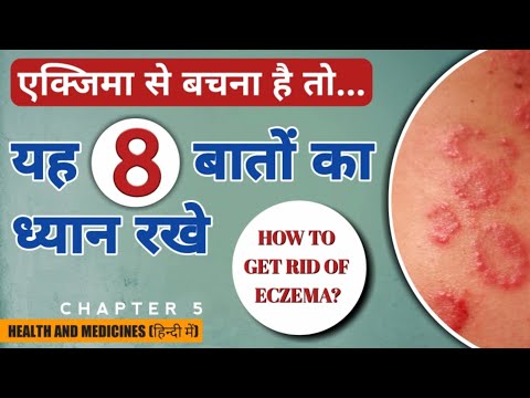 एक्जिमा-से-कैसे-बचे-|-how-to-get-rid-of-eczema-|-एक्जिमा-से-बचाव