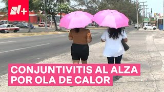 Ola De Calor Aumenta Casos De Conjuntivitis - N+