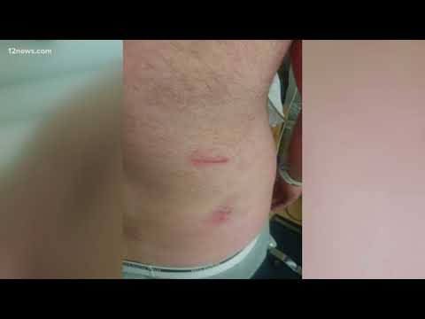 Man attacked by Banner security after experience a medical episode