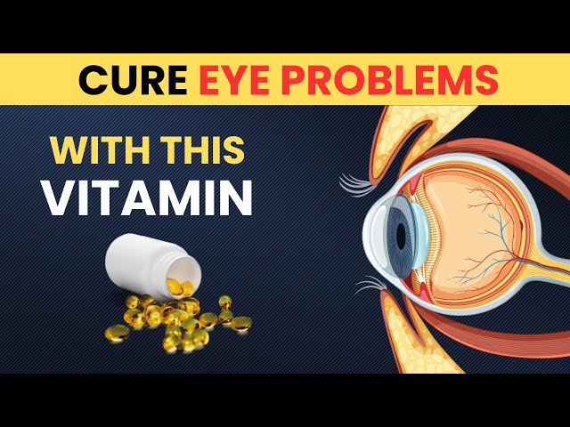 One Vitamin to Cure Eye Problem Permanently | Vitamins | Eye care Tips