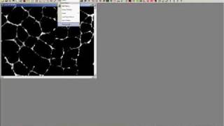 Angiogenesis Analysis - Image-Pro Plus Software