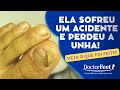 Unha com trauma pós acidente!