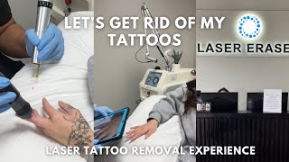 LETS GET RID OF MY TATTOOS (Come w/ me Laser Tattoo Removal)