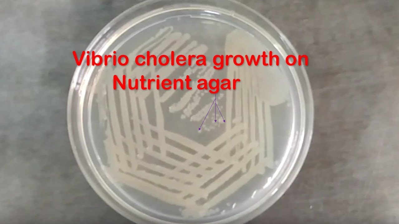 Nutrient Agar with growth of Vibrio cholerae YouTube