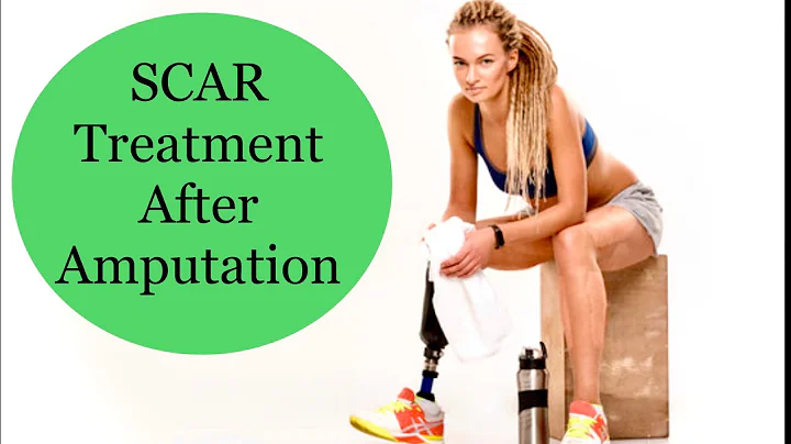 Chapter 1:SCAR MOBILISATION AFTER AMPUTATION /CHAP 2:HOW TO APPLY A COMPRESSION  AFTER AMPUTATION