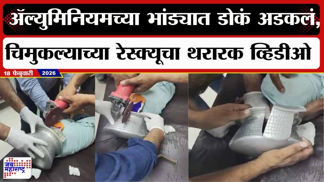 Jalgaon : ॲल्युमिनियमच्या भांड्यात डोकं अडकलं,चिमुकल्याच्या रेस्क्यूचा थरारक व्हिडीओ | Marathi News