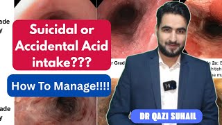 Acid & Alkali Ingestion: Emergency Management Explained | Gastroenterology Lecture