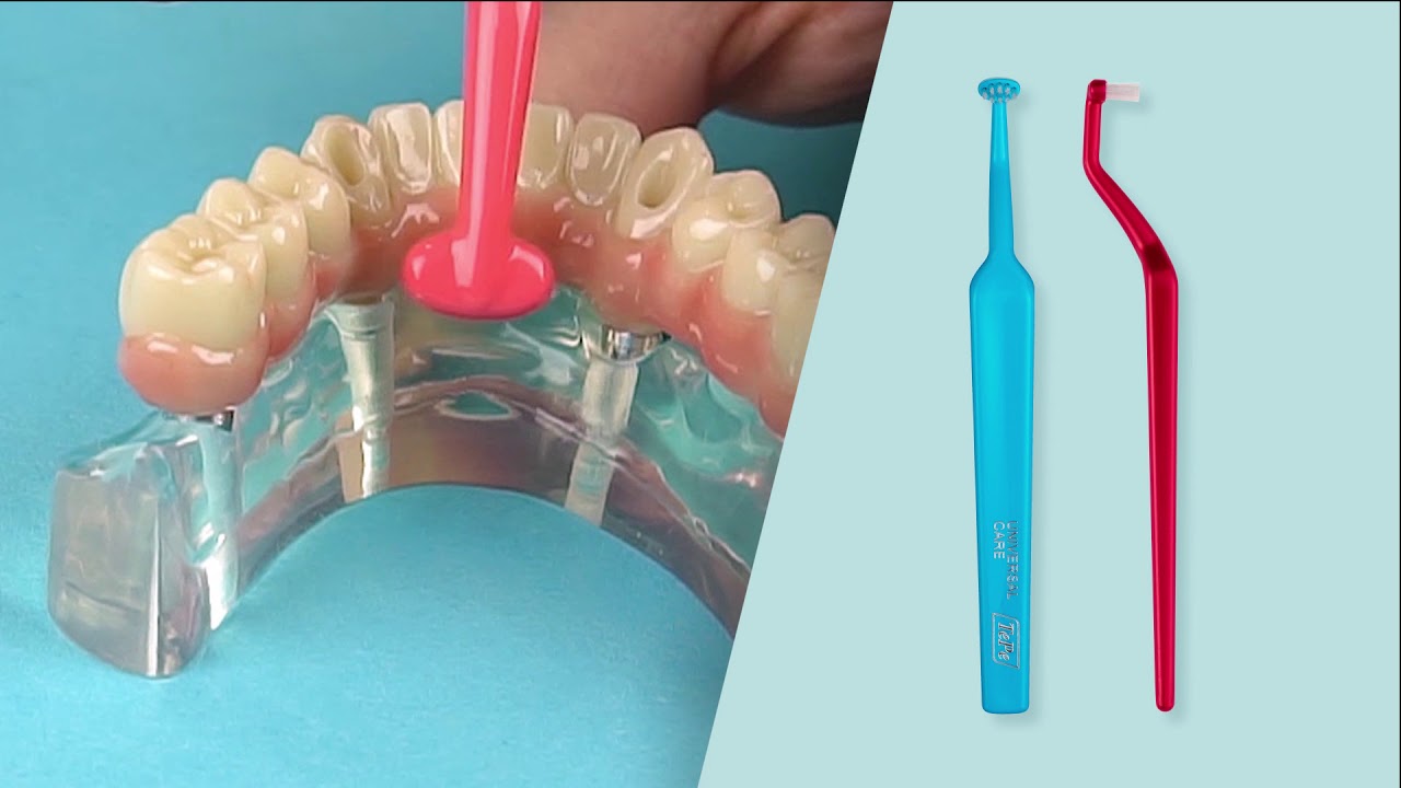 TePe Implant Orthodontic™ - Toothbrush for Dental Implants – TePe USA