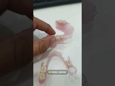 تركيبات الاسنان المتحركة المرنه