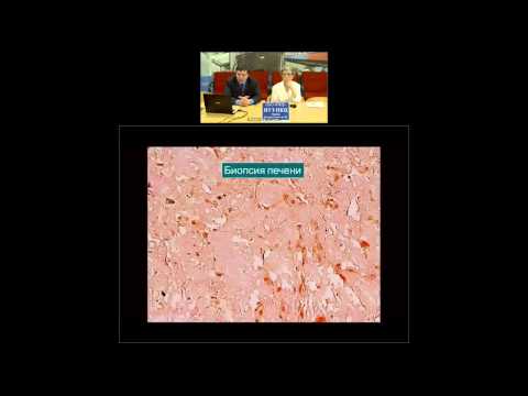 Видео: Варикозно-образная сыпь Капоши у пациента с метастатической меланомой и первичной кожной анапластической крупноклеточной лимфомой, получавшей талимоген Лахерпарепек и ниволумаб