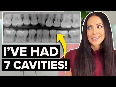 Even Dental Professionals Get Cavities!