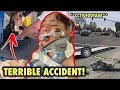 Footage of Nidal Wonder Being Hit by a Car while Riding a Scooter | Nidal Wonder Car Accident CCTV