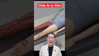 Review - Ghép Da Tự Thân Ở Vùng Tổn Thương Lớn 