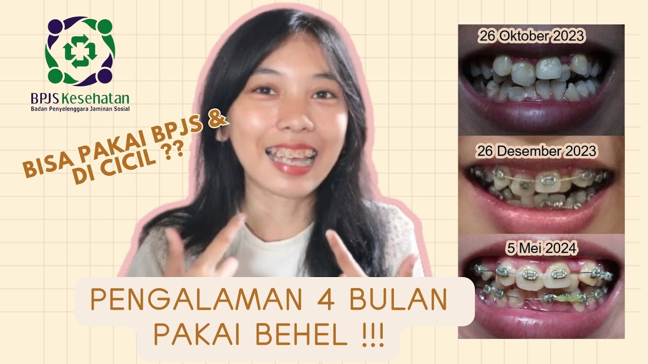 PENGALAMAN PASANG BEHEL BISA PAKAI BPJS DAN DI CICIL ?? #behel # PENGALAMAN PASANG BEHEL BISA PAKAI BPJS DAN DI CICIL ?? #behel #