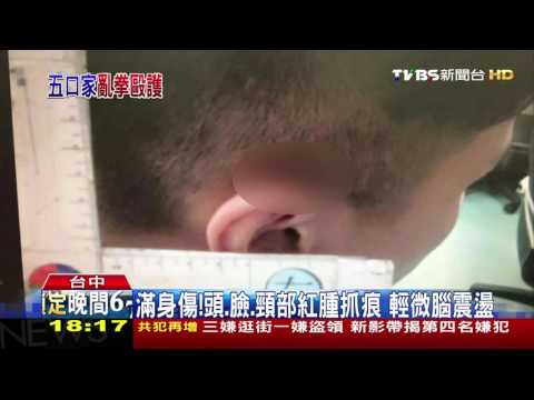 【TVBS】5個打1個！急診室護理師　遭病患家屬圍毆