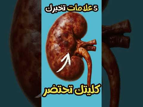 5 إشارات تحذيرية لفشل الكلى ستنقذ حياتك