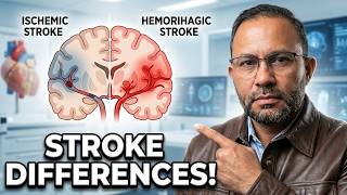 Download Lagu Ischemic vs Hemorrhagic: Which Stroke Kills Faster?