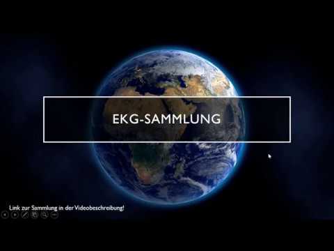 KOSTENLOSE EKG-SAMMLUNG FÜR ALLE :)