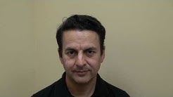 Indian Hispanic Middle Eastern Bald Men Hair Transplant