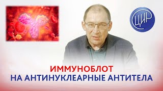 Лабораторная диагностика аутоиммунных заболеваний. Иммуноблот на антинуклеарные антитела.