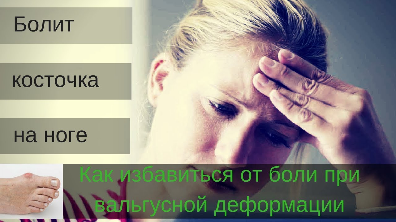 Болит косточка на ноге 3 способа избавиться от боли в косточке на ноге ...