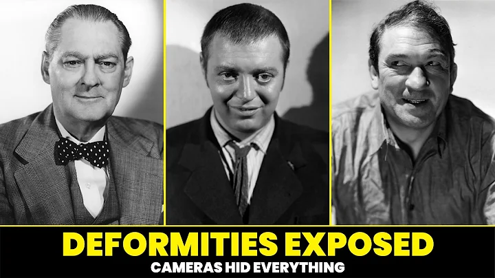 Golden Age Hollywood Stars with secret disabilities and deformities