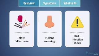 NOSEBLEEDS - First Aid in 60 Seconds