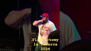 Flaytectomy - Flaytectomy
