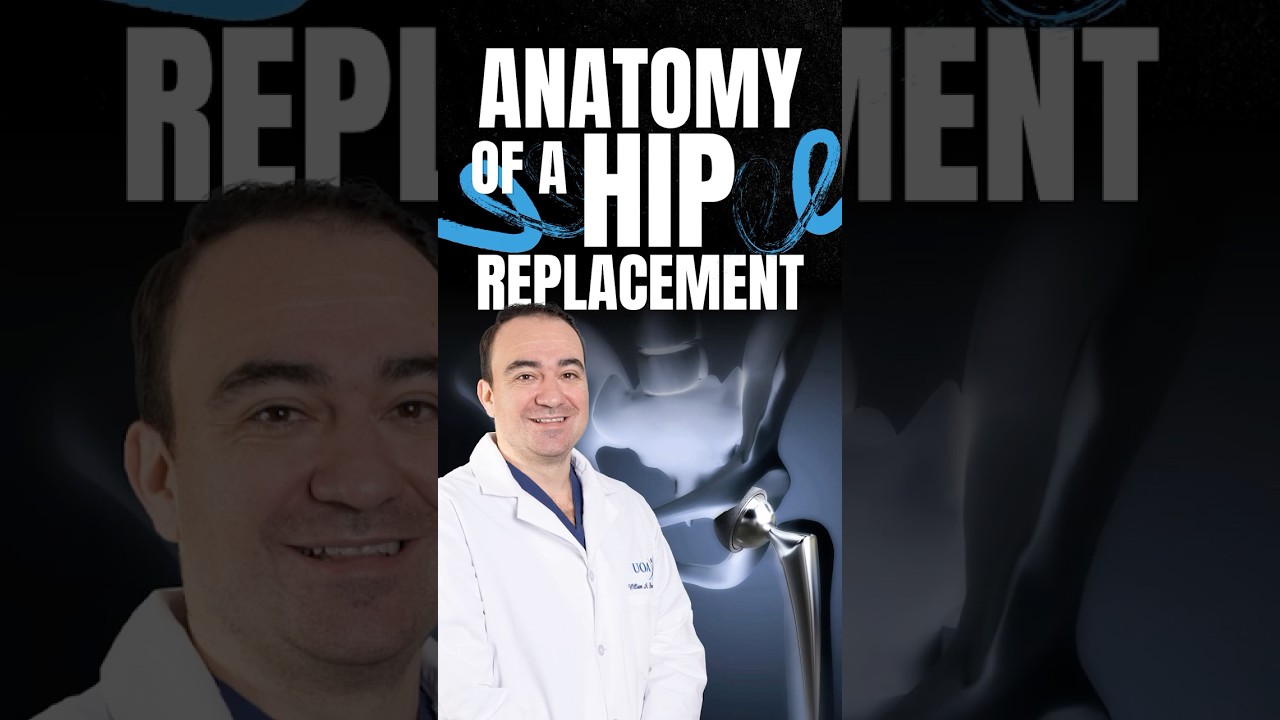 Anatomy of a Hip Replacement