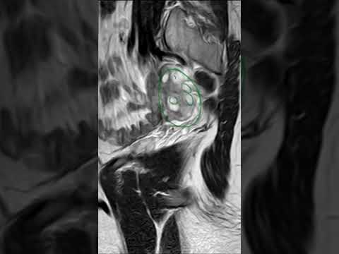 التمرين 7 الحلقة الكاملة على    6