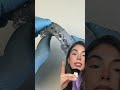 Contenciones post ortodoncia con brackets #shorts