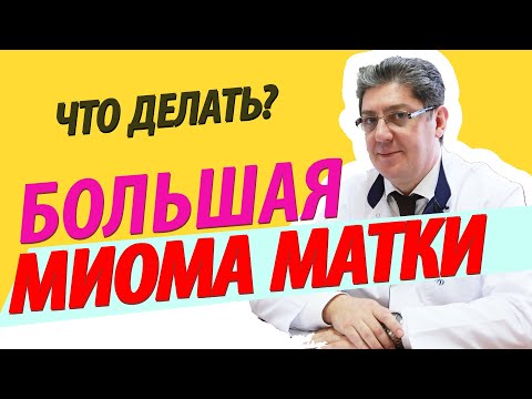 Большая миома матки (большой миоматозный узел)