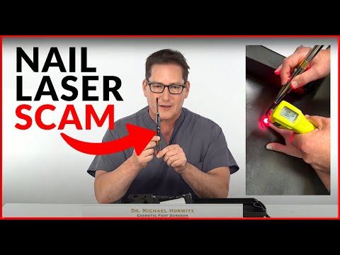 Nail Laser Scams- DIY   Home Fungus Toenail Lasers   Do They Really Work?