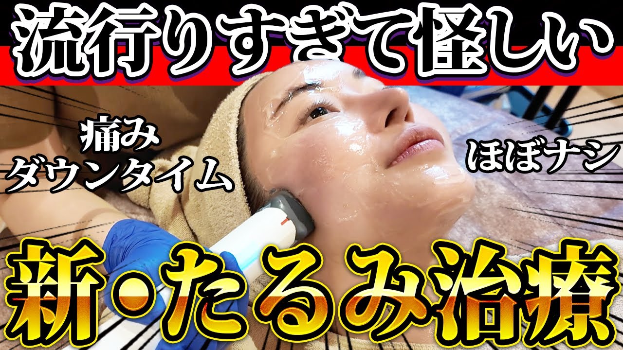 【世界でバズる】最新・たるみ治療ザーフで垢抜け！！！