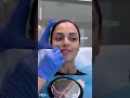Comprehensive Consultation and Preparation for Cosmetic Injectables