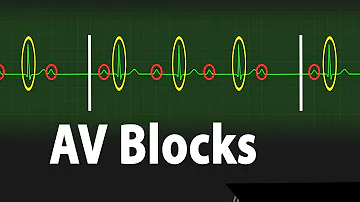 Ist ein AV-Block ein Herzinfarkt?