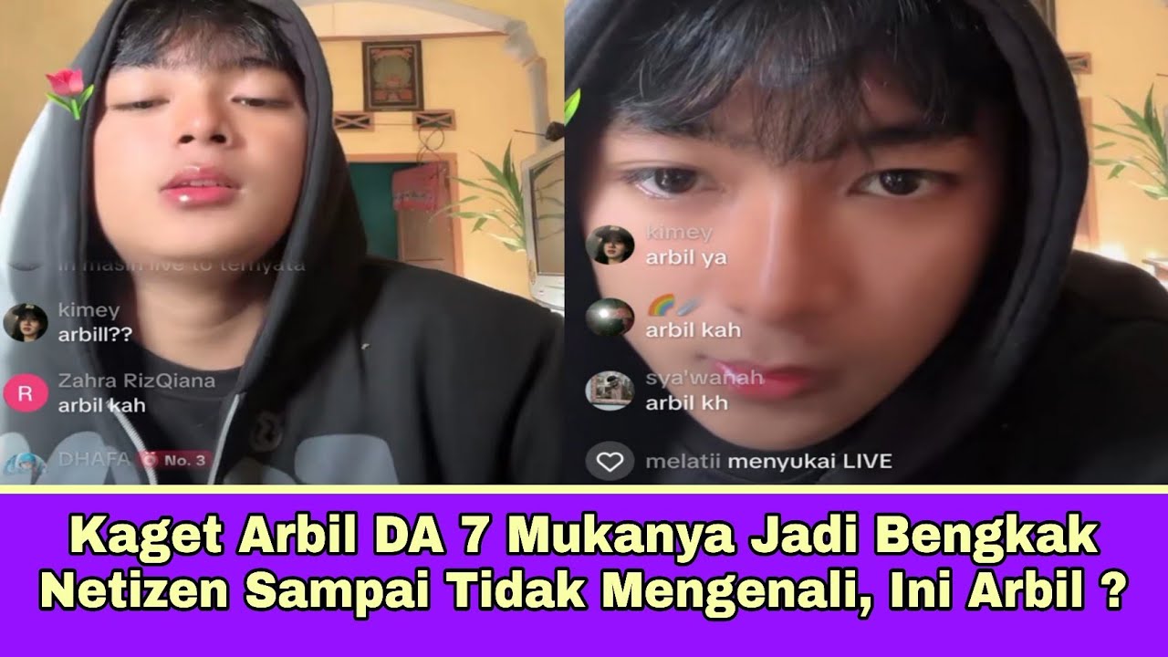 Kaget Arbil DA 7 Mukanya Jadi Bengkak, Netizen Sampai Tidak Mengenali, Ini Arbil ?