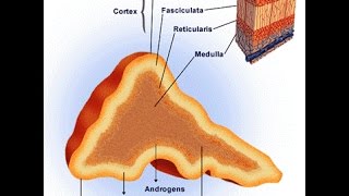 Pheochromocytoma