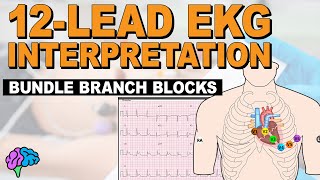 Bundle Branch Blocks MADE EASY!!  12 Lead EKG