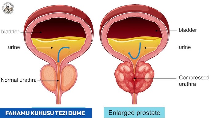 Fairy Tail yaoi porno