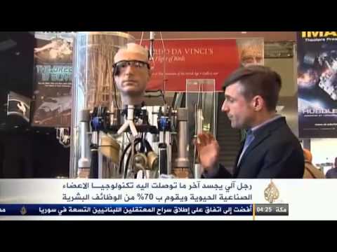 إمكانية تطور تكنولوجيا الأطراف الصناعية