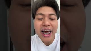 Kontrol pertama pasang behel #behelgigi #pasangbehel #dentist #braces