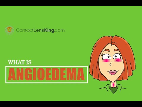 Angioedema | What is Angioedema and how is it treated?