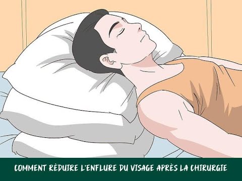 Vidéo: 3 façons de réduire l'enflure du visage