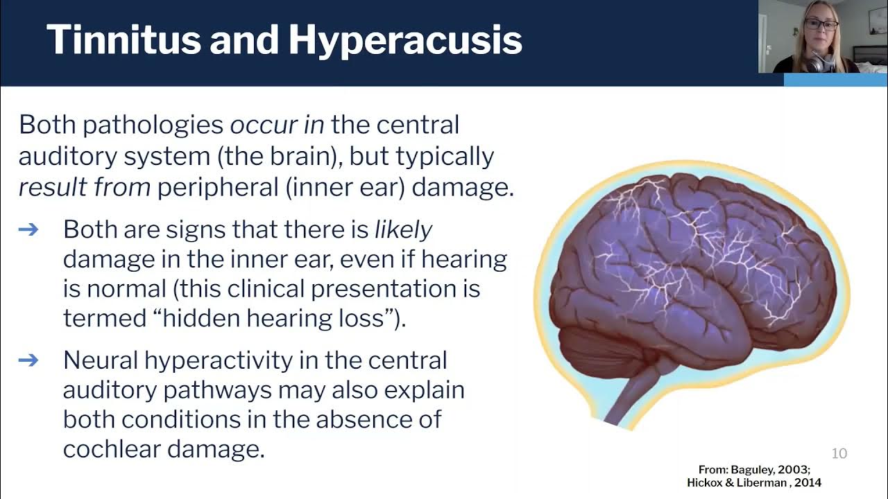 What is Hyperacusis? YouTube