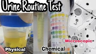 Urine Routine Test Urine Ysis Chemical Physical And Microscopic Exmination Mlt