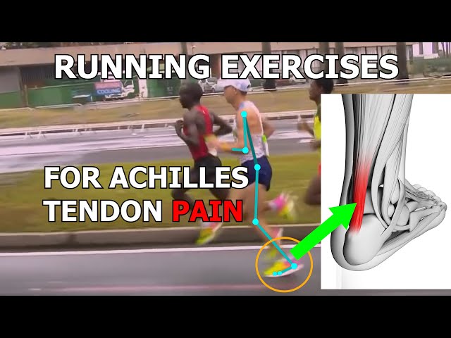 Sore Achilles tendon in the morning? Causes and treatment