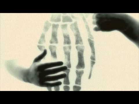 Kaava - Hypnoosi