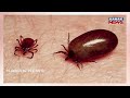 ଗାଁରେ ବ୍ୟାପୁଛି ସ୍କ୍ରବ୍ ଟାଇଫସ୍ | Scrub Typhus Alert in Angul: 39 Test Positive in Sanabaghdari