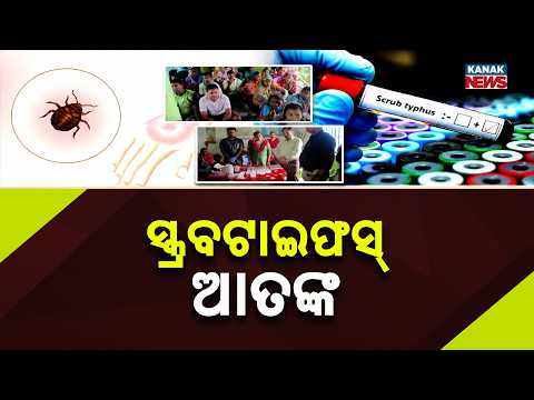 ଗାଁରେ ବ୍ୟାପୁଛି ସ୍କ୍ରବ୍ ଟାଇଫସ୍ | Scrub Typhus Alert in Angul: 39 Test Positive in Sanabaghdari